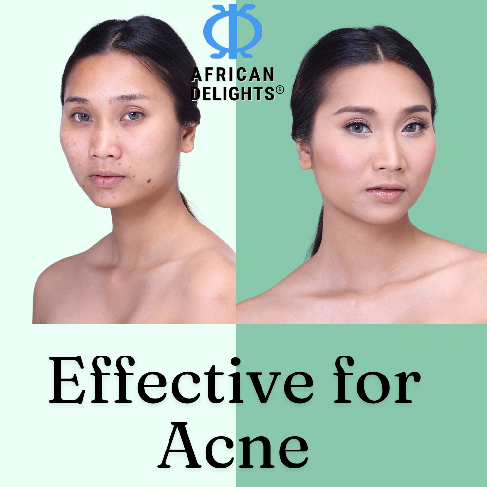 Village Fresh Herbal Black Soap